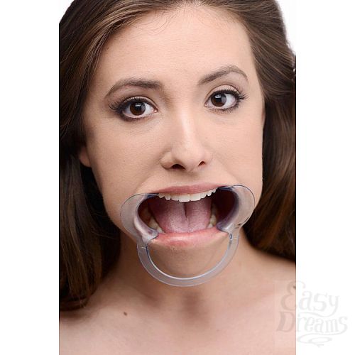  3    Cheek Retractor Dental Mouth Gag